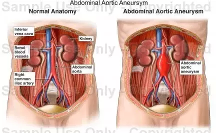 left side of stomach pulsing