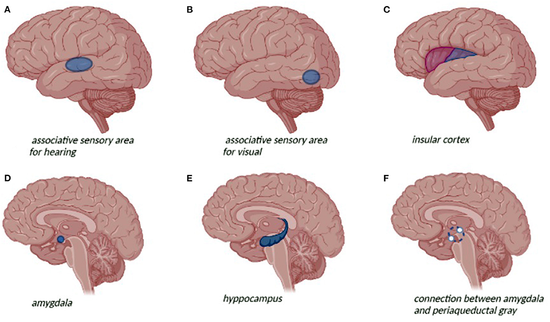 what is temporal lobe epilepsy