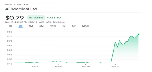 4dx share price