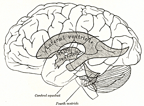 cerebral aqueduct stenosis