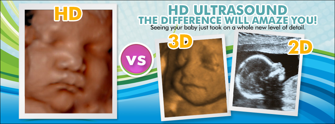 3d sonogram dallas