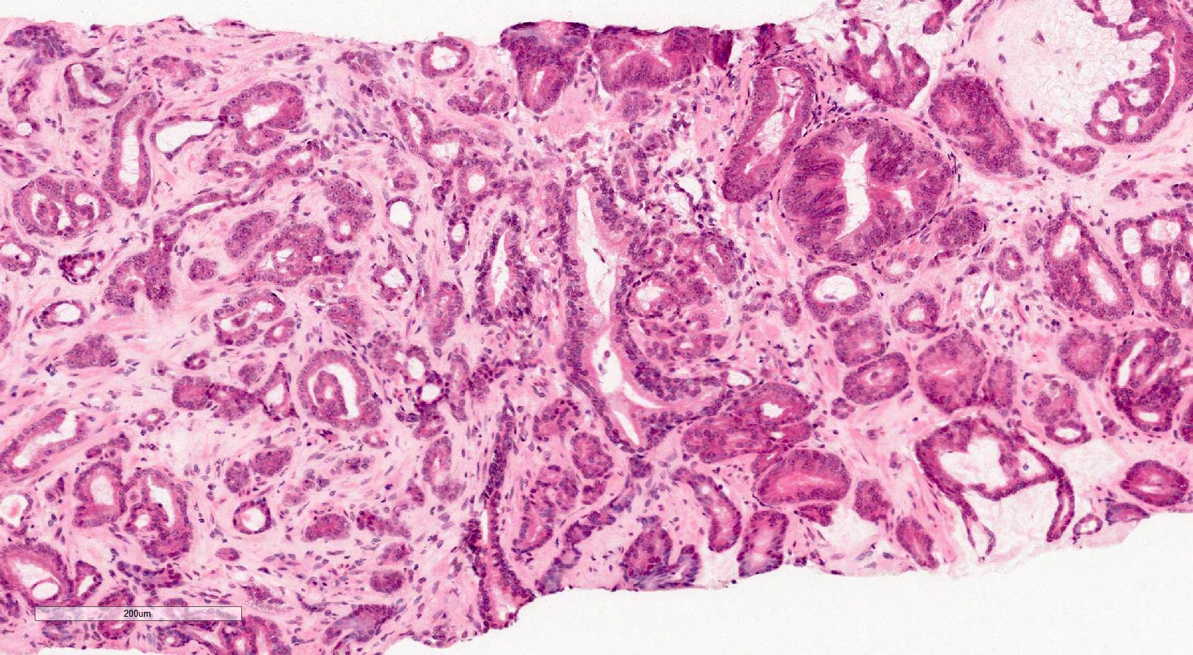 prostate pathology outlines