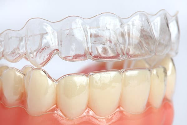 www invisalign doctor site