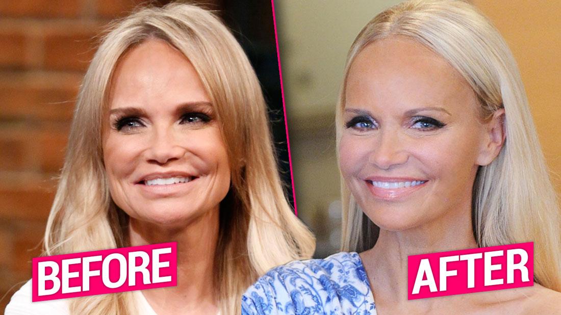 kristin chenoweth boob job