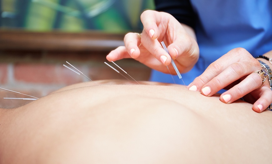 austin chinese acupuncture & herb clinic