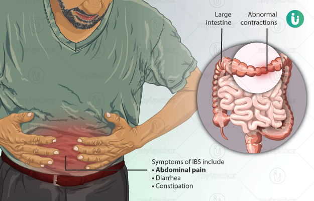 amasa disease in english