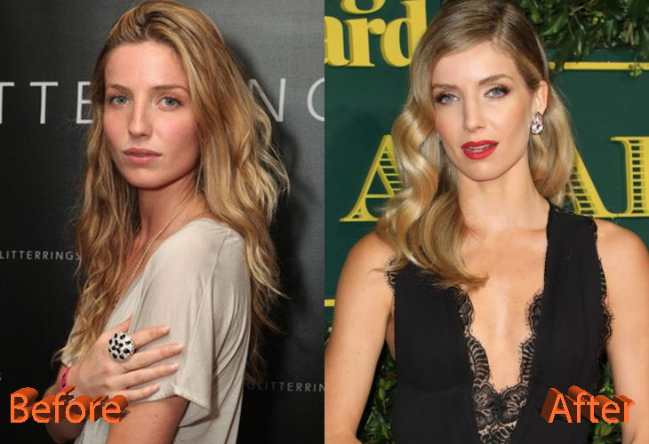 annabelle wallis nose surgery