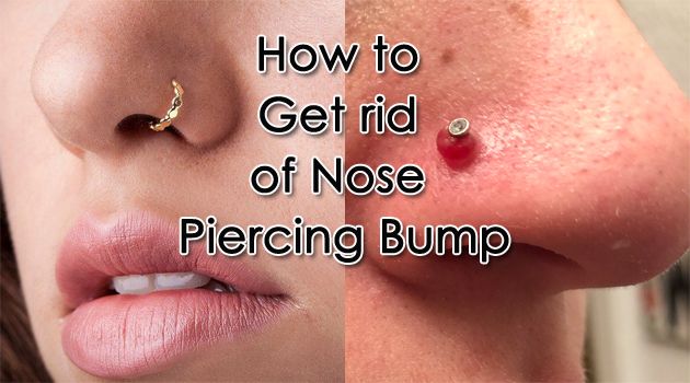 how to get rid of a piercing bump on nose