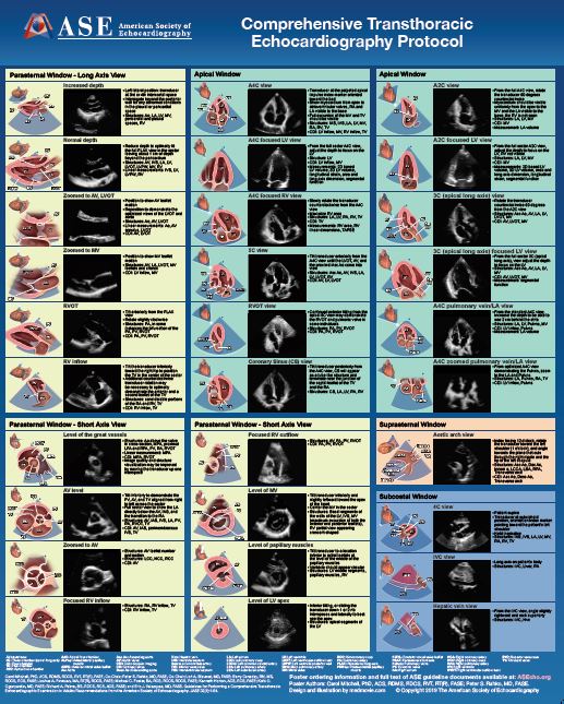 echocardiography poster