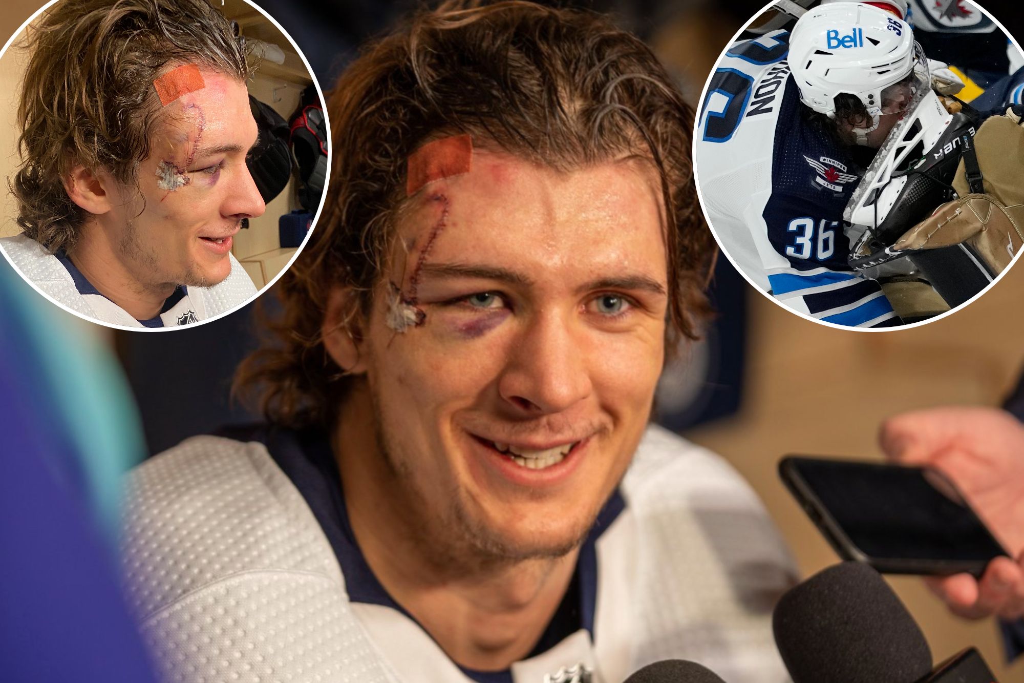 hockey player 75 stitches picture