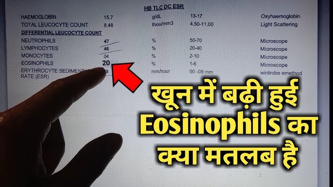 basophils test in hindi