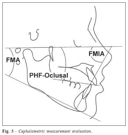 fmia