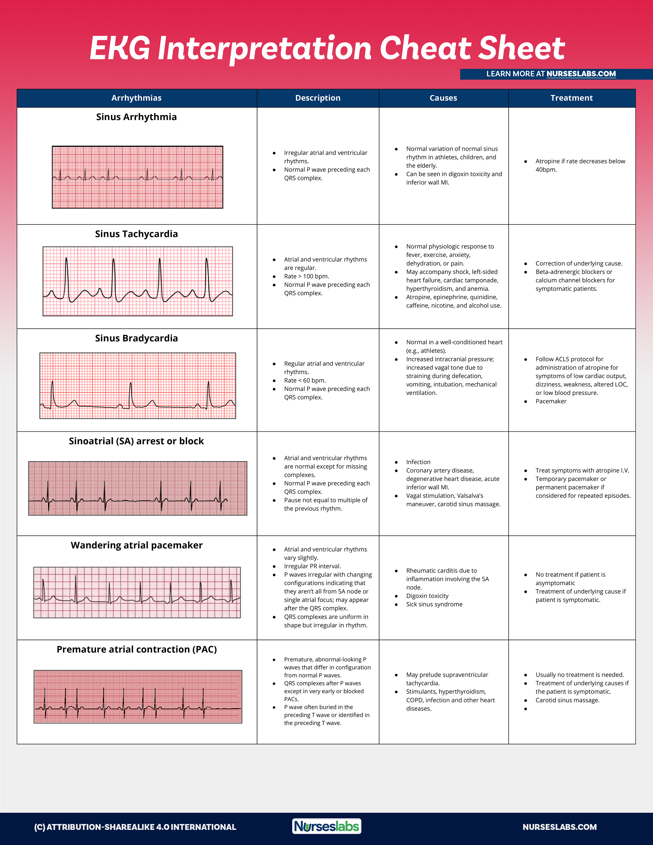 free ekg practice