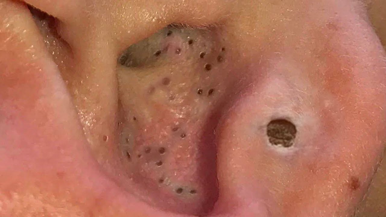 zit pop video