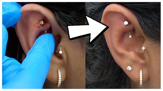 rook piercing infection