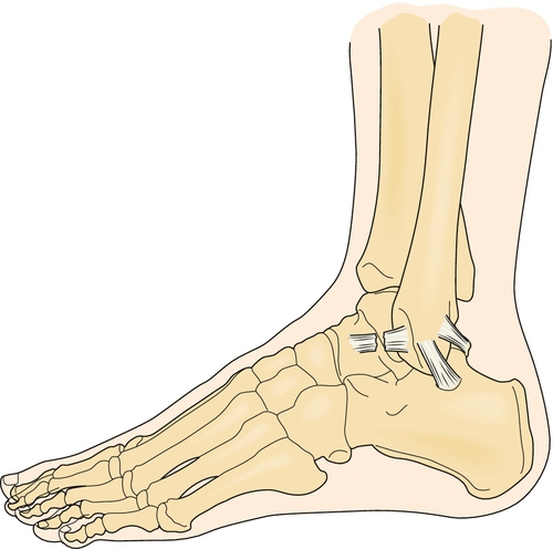 sprain of ankle icd 10