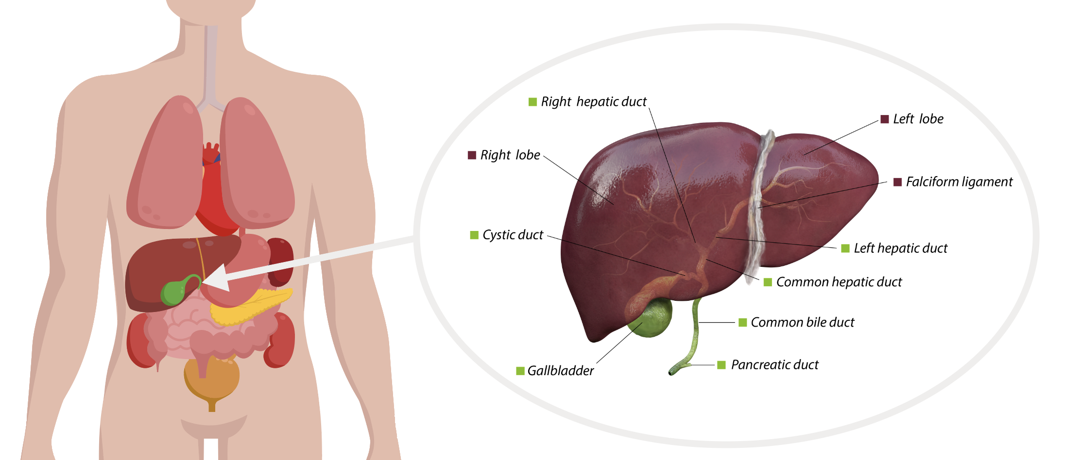 focal nodular hyperplasia liver