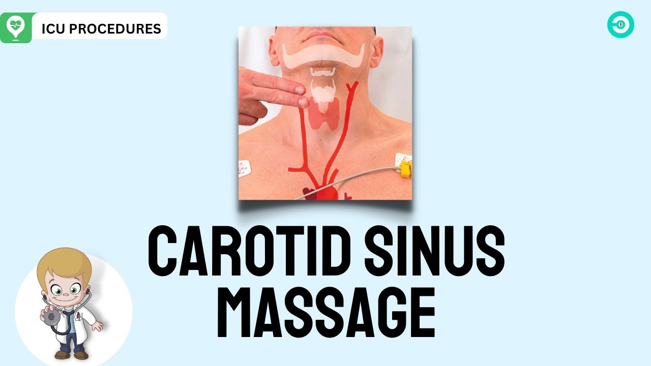 carotid massage for svt