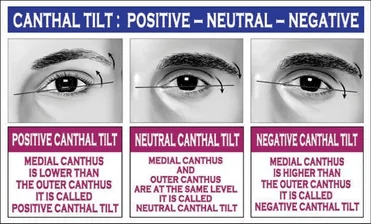 neutral canthal tilt