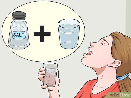 how to get rid of the flu wikihow