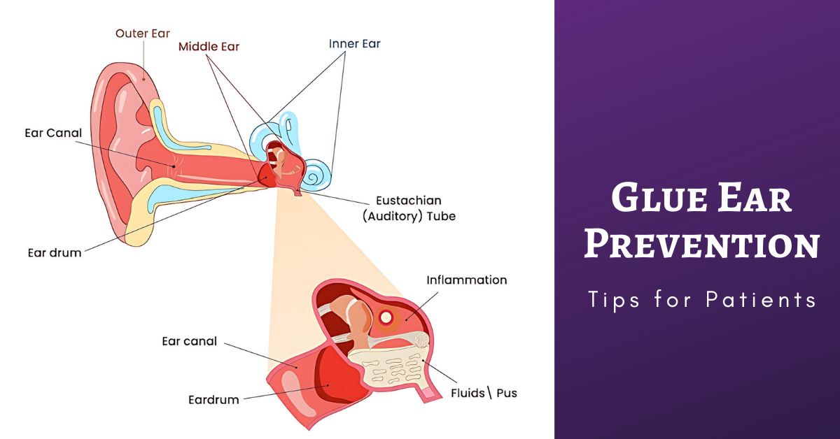 glue ear tips adults