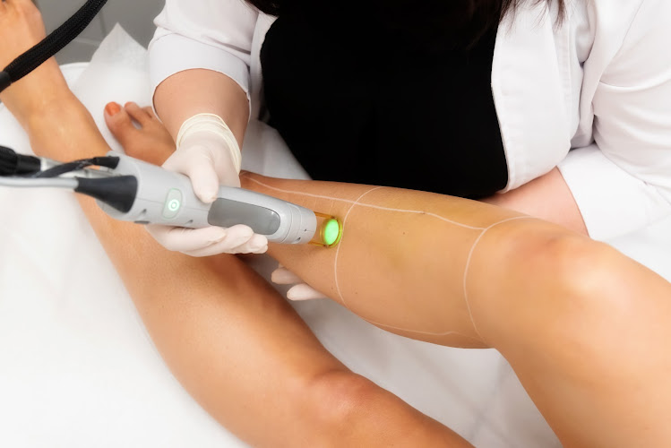 laser hair removal airdrie