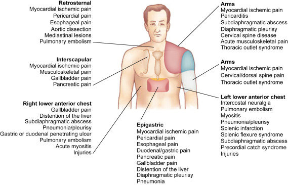 acute costochondritis icd 10