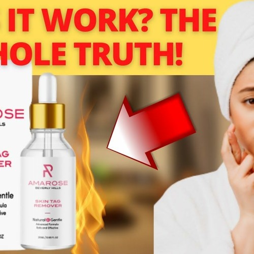 amarose skin tag remover