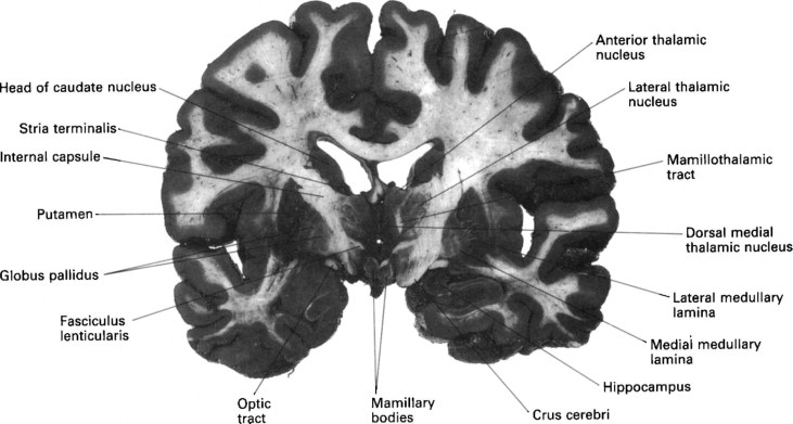 caudate nucleus