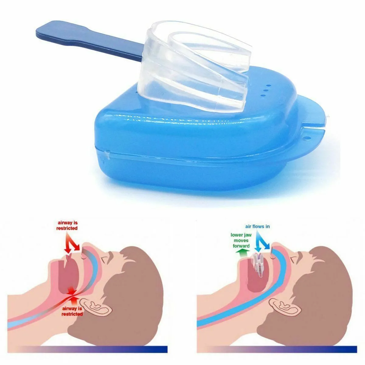 best rated anti snoring mouthpiece