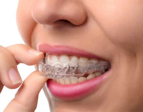 dental braces for kids maple ridge