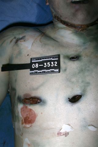 jodi arias travis autopsy photos