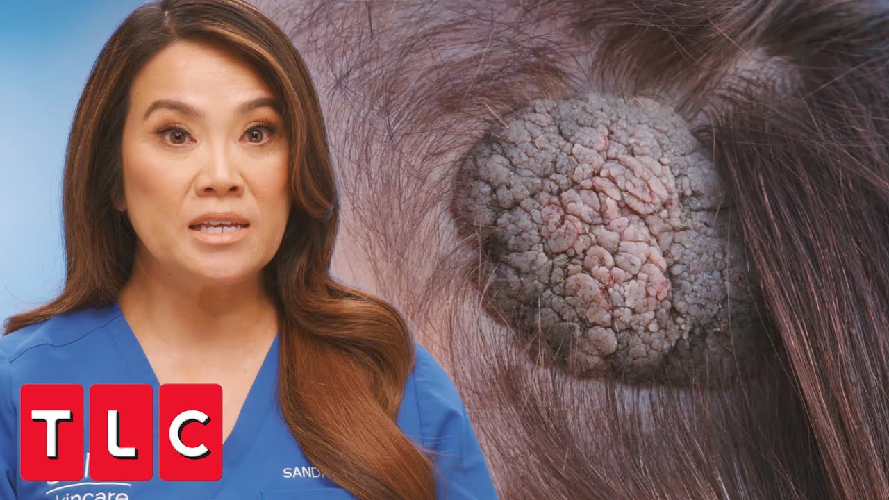 dr pimple popper episodes