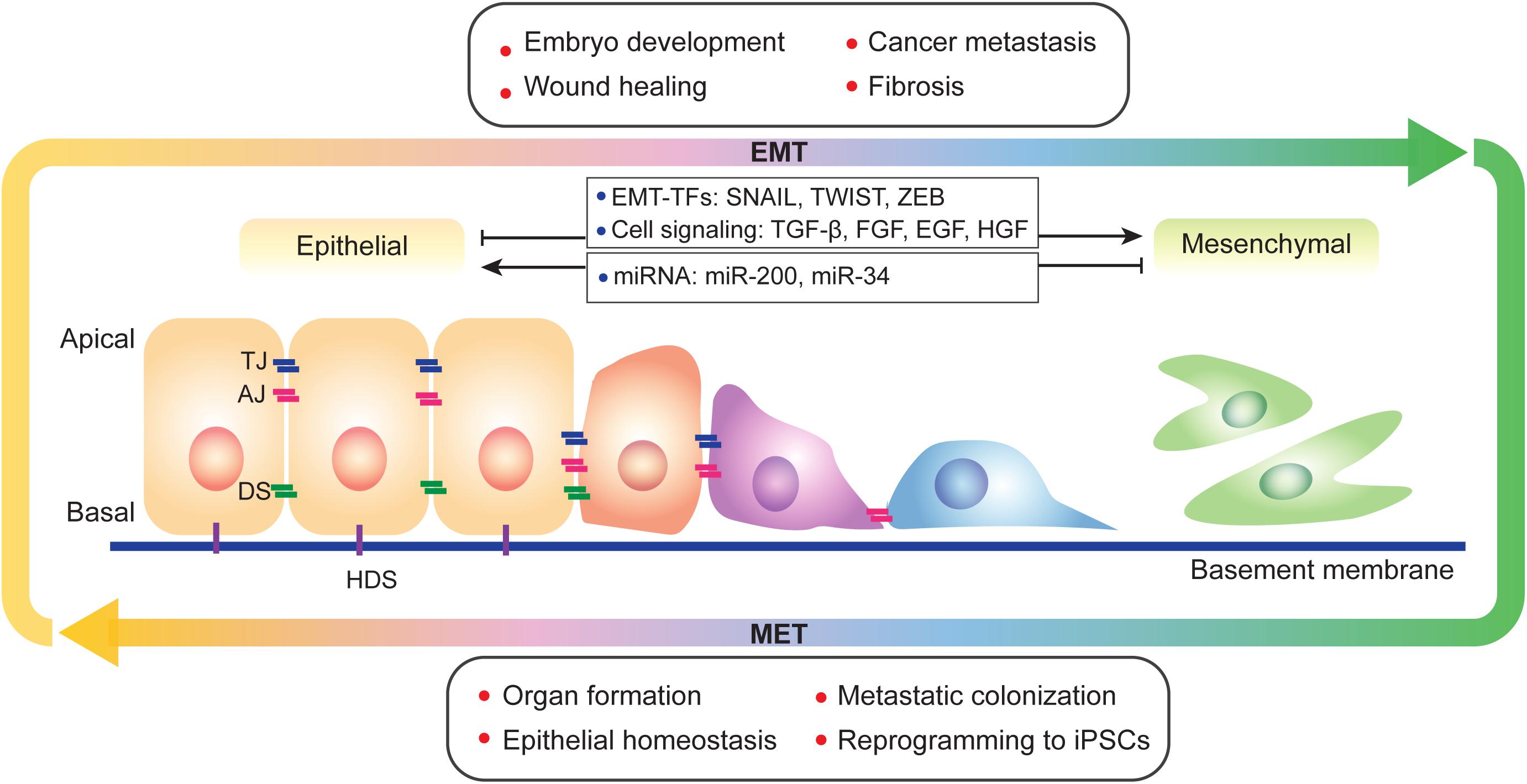 emt epithelial mesenchymal transition