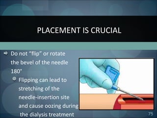 flipping the arterial vascular access needle