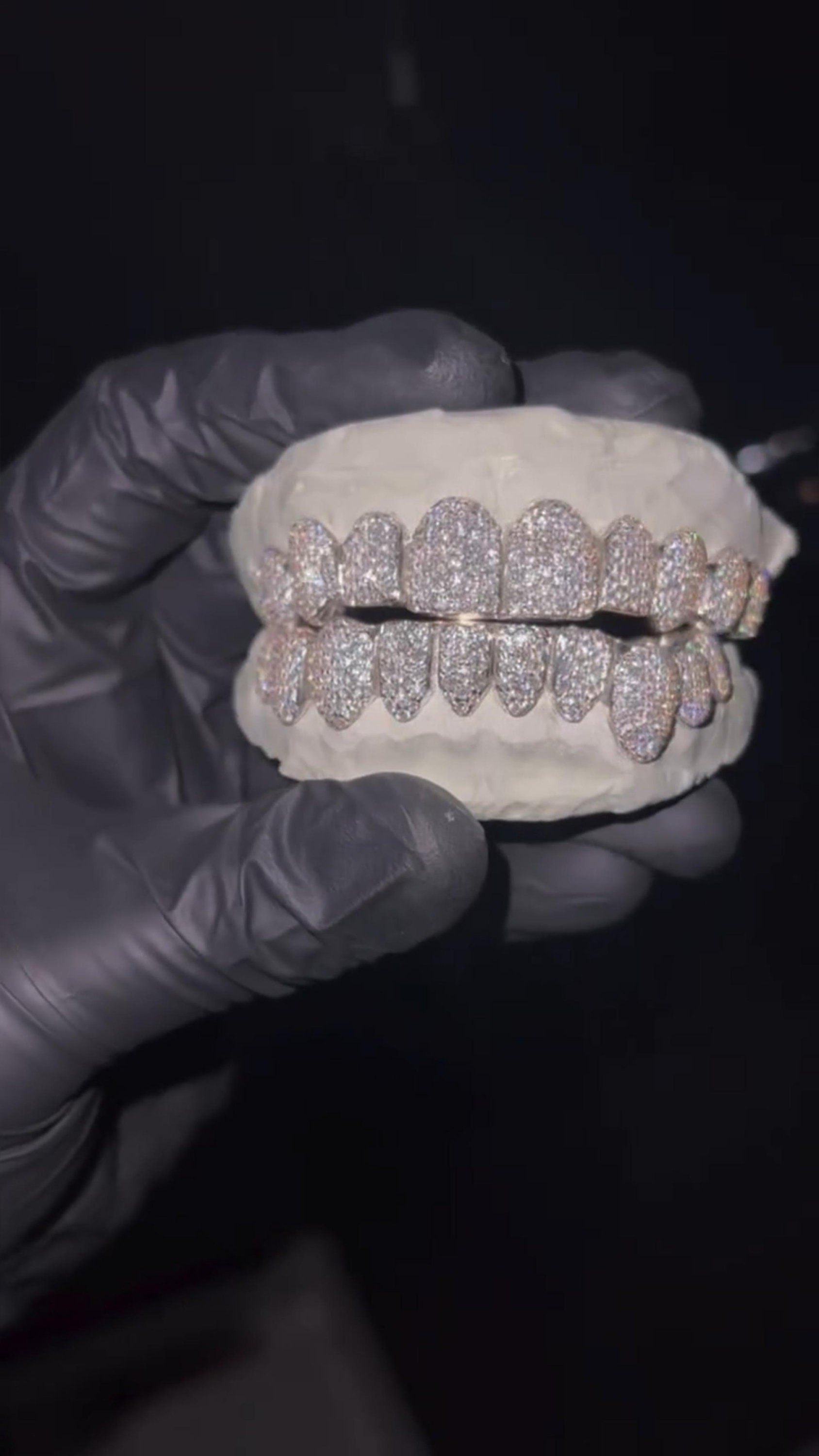 iced out grillz