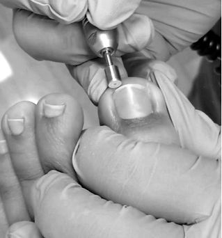 medical pedicure seattle