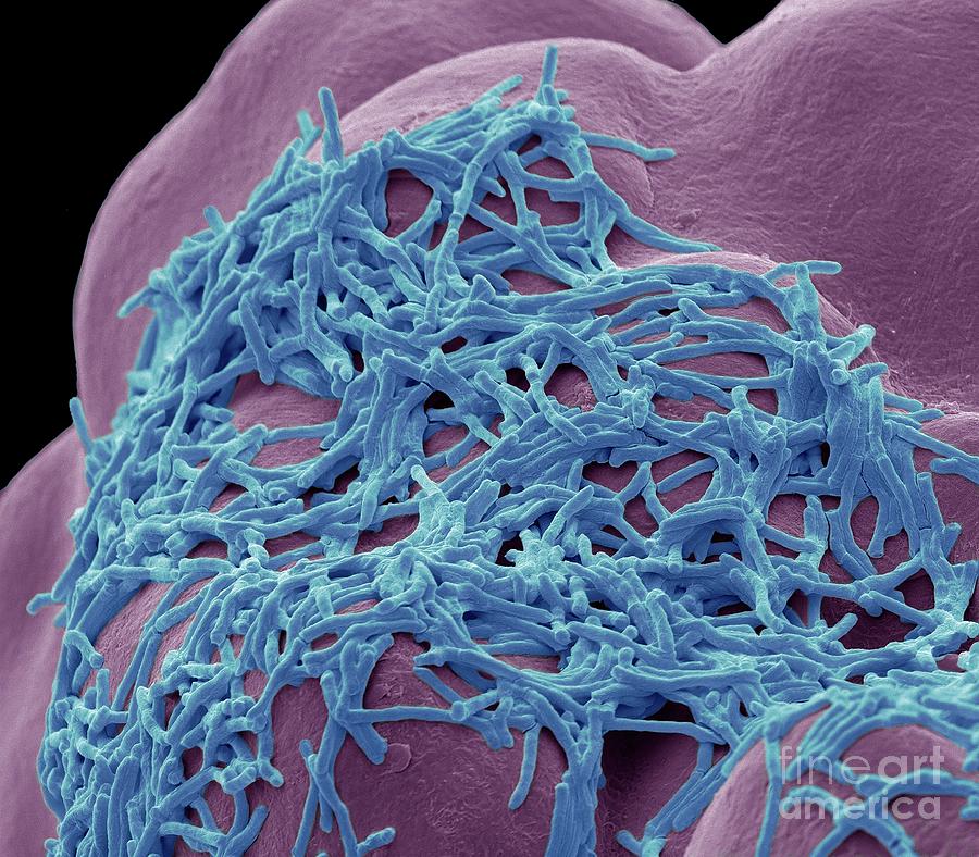 mycobacterium smegmatis