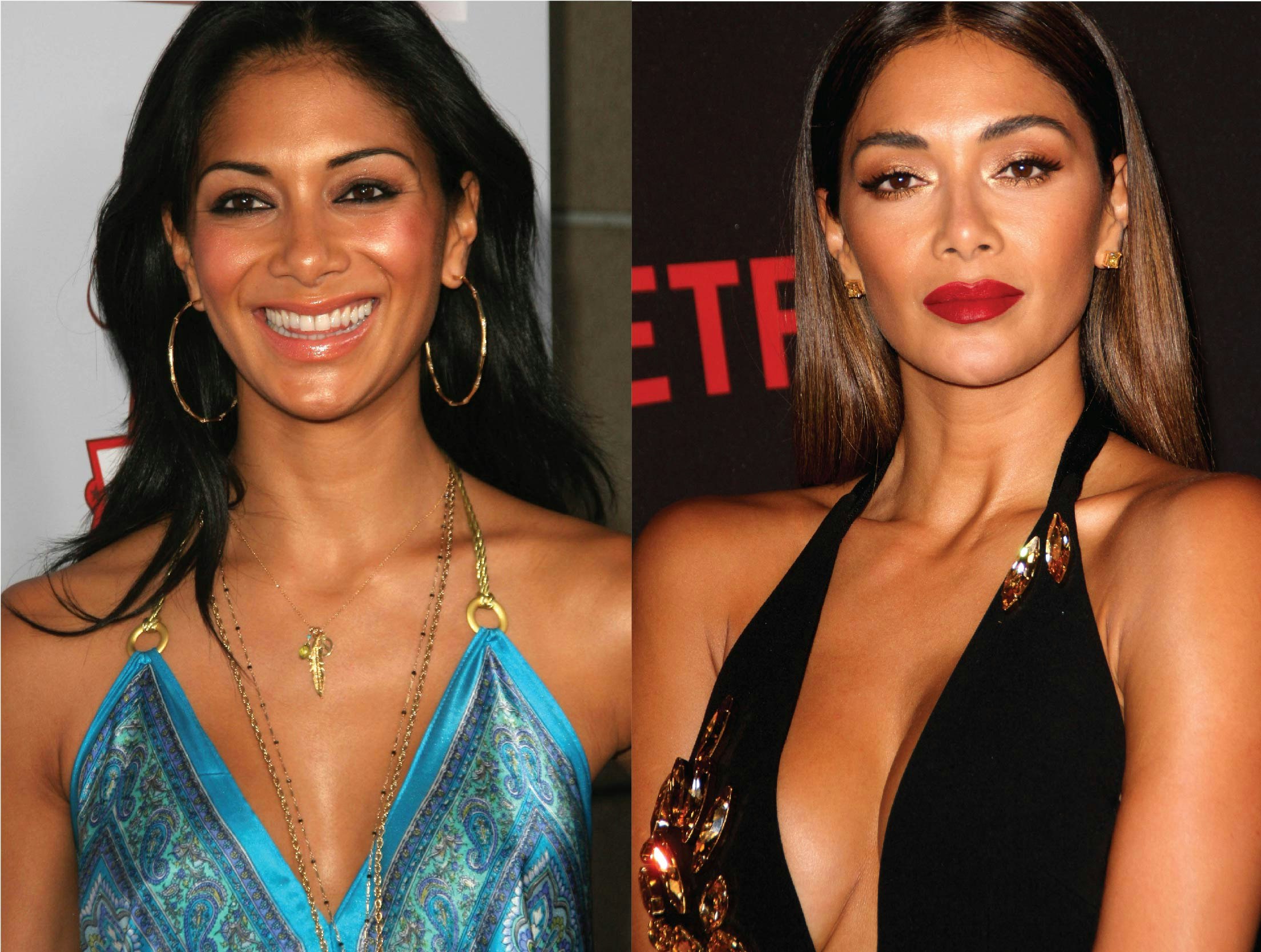 nicole scherzinger breast implants