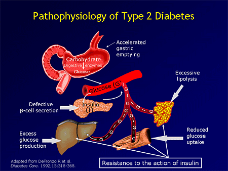 pathophysiology