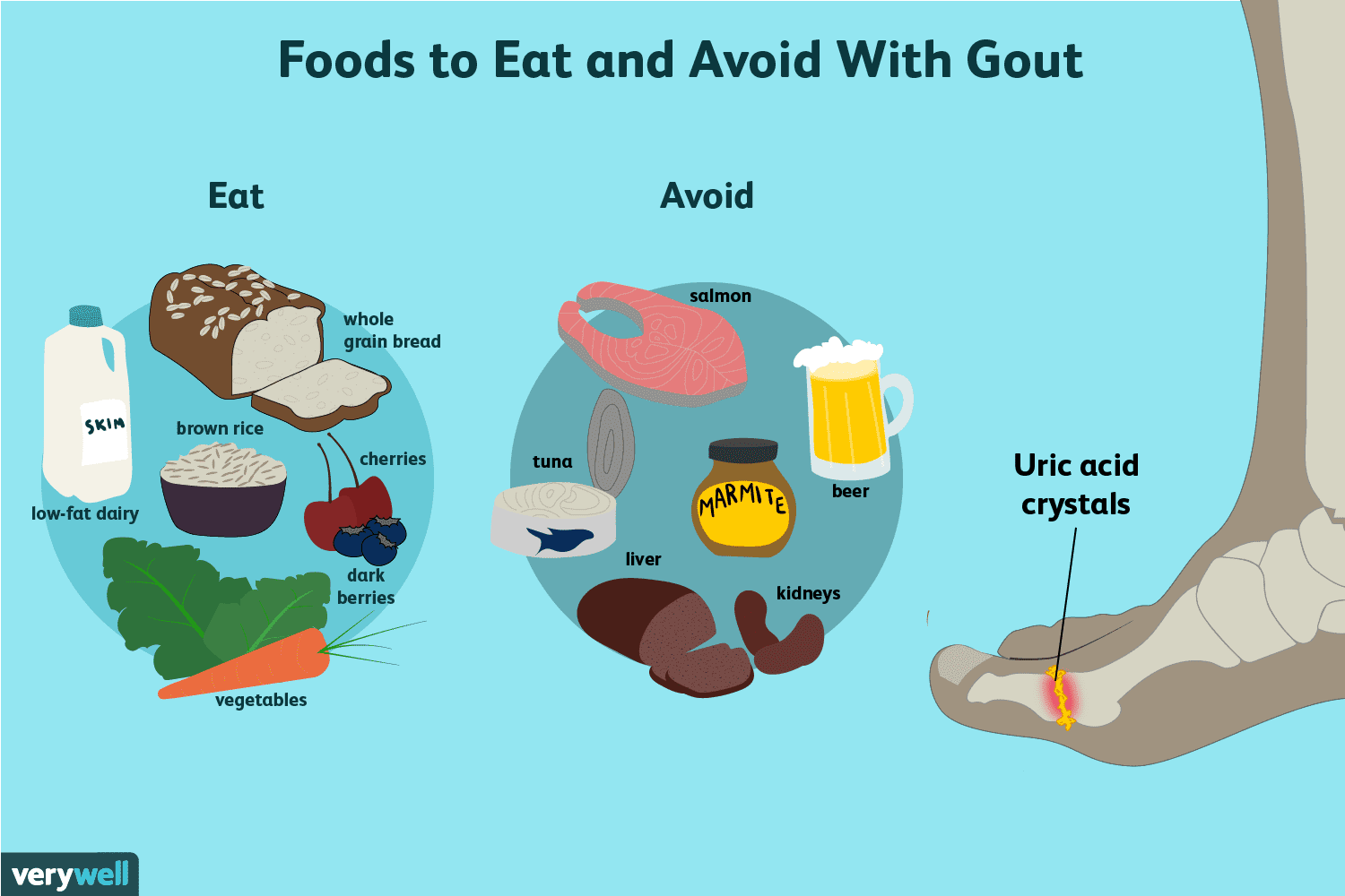 printable gout diet