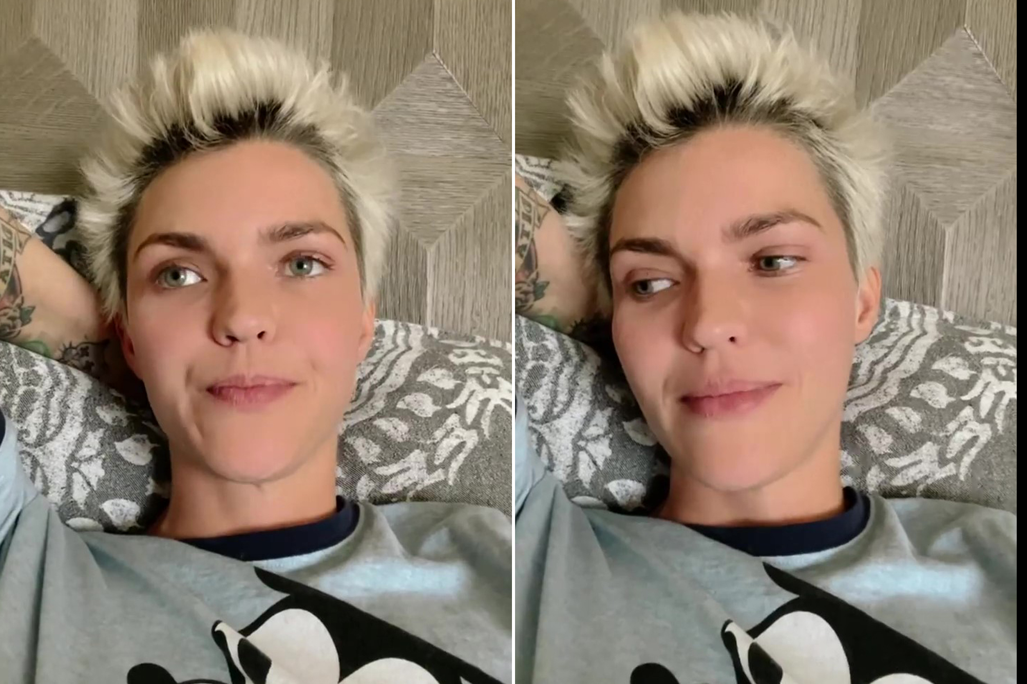 ruby rose plastic surgery