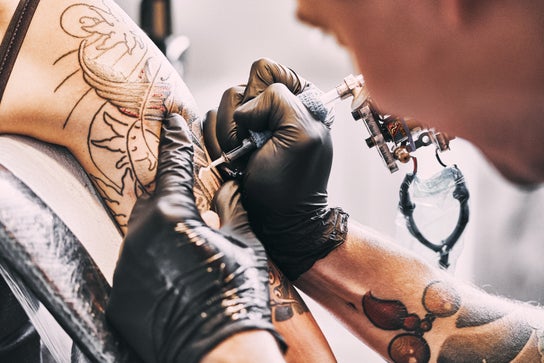 tattoo removal madrid